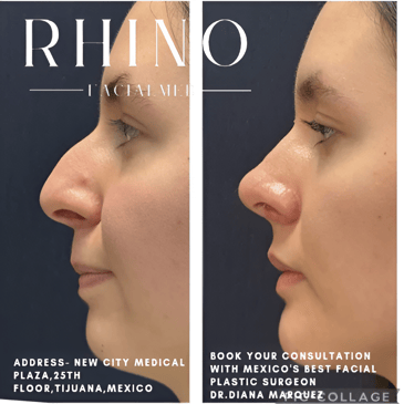Slider image (4) Aesthetic and Oncologic Face, Head and Neck Clinic and OR